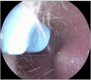 Vital Ear Cleaner 20